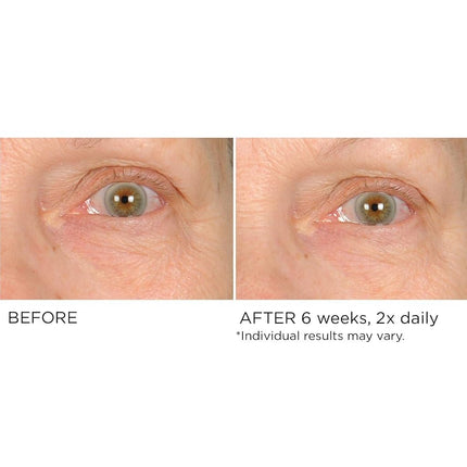 NassifMD Crema para Contorno de Ojos - Crema Iluminadora para el Cuidado de los Ojos, Crema Antiarrugas para Ojos (0.5 fl oz)