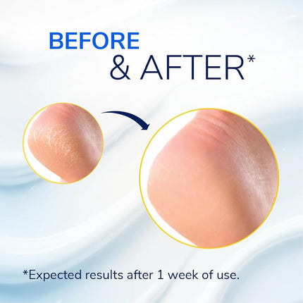 Dr. Scholl’s® Severe Cracked Heel Balm