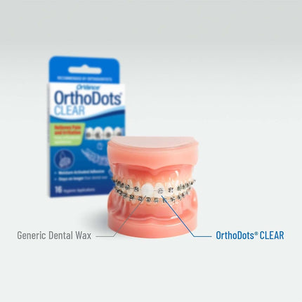OrthoDots CLEAR - Moisture Activated, Silicone Dental Wax Alternative for Pain Caused by Braces. OrthoDots Stick Better & Stay on Longer than Orthodontic Wax 24 Count Clear
