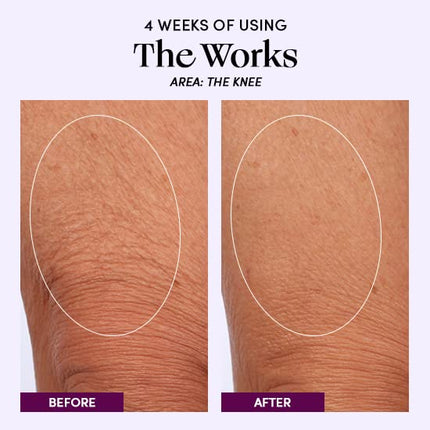 Womaness The Works Crema Corporal Alisadora Todo en Uno - Cuidado de la Piel para la Menopausia, Loción Corporal Hidratante y Tratamiento Tonificante para Piel Crepé - Crema Reafirmante con Niacinamida y Ácido Hialurónico (200ml)