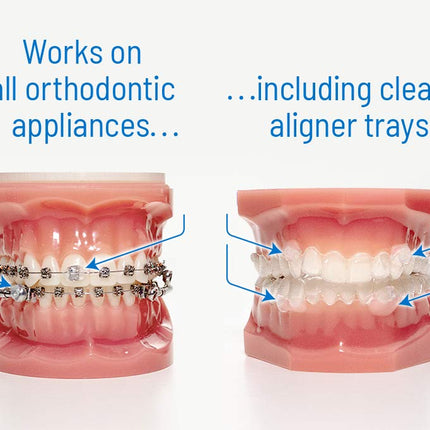 OrthoDots CLEAR - Moisture Activated, Silicone Dental Wax Alternative for Pain Caused by Braces. OrthoDots Stick Better & Stay on Longer than Orthodontic Wax 24 Count Clear