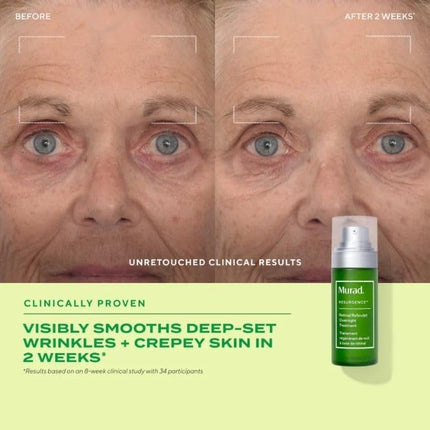 Murad Retinal ReSculpt Overnight Serum - Vitamin A Night Skincare for Fine Lines, Wrinkles, Sagging and Crepey Skin, Face & Neck, 30 mL