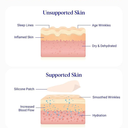 Wrinkles Schminkles Under Eye Patches - Rejuvenate Wrinkles with Medical Grade Silicone Reusable Anti-Wrinkle Patches for Under Eye Treatment, Banish Dark Circles (3 Pairs)