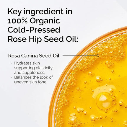 The Ordinary 100% Organic Cold-Pressed Rose Hip Seed Oil, Addresses Signs of Aging by Improving the Appearance of Uneven Skin Tone, Supporting Skin Elasticity, 30ml