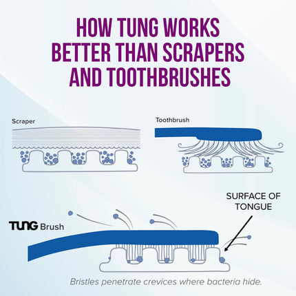 (2 Pack) - The Original TUNG Gel - 2 Pack