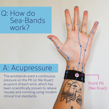 Sea-Band Wristband, Adult, Colors May Vary, 1 Pair, Anti-Nausea Acupressure Motion or Morning Sickness, 2 Count (Pack of 1)