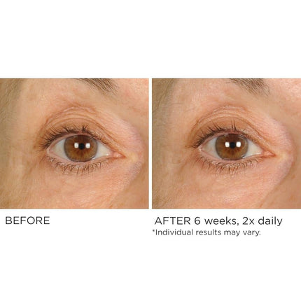 NassifMD Crema para Contorno de Ojos - Crema Iluminadora para el Cuidado de los Ojos, Crema Antiarrugas para Ojos (0.5 fl oz)