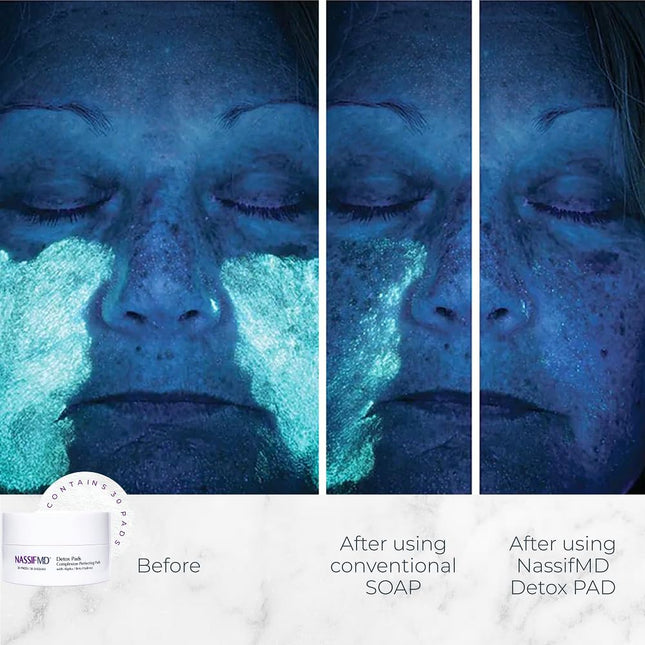 NASSIF MD Face Detox Pads, 30 Count