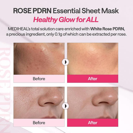 MEDIHEAL Rose PDRN Essential Face Sheet Mask, Healthy Glow (10ea)