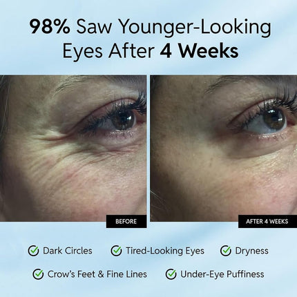 Eliré Anti-Aging Eye Cream - Smooths Wrinkles, Firms and Hydrates