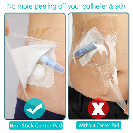 Waterproof Shower Protector | 10x10 Inch Dialysis Catheter Shower Cover Large | Without Glue in The Center for Chest Chemo Port Picc Line PD Peritoneal Dialysis Accessories Bandage (Pack of 25)