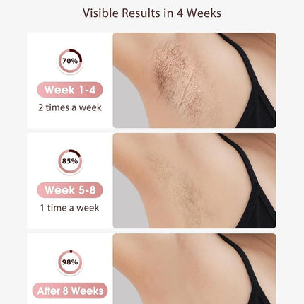 LYSMOSKI Laser Hair Removal, IPL Hair Removal with Ice-Cooling System for Painless & Long-Lasting Result, Safe At-Home Hair Remover Device for Armpits Back Legs Arms Face Bikini Line