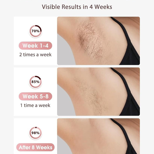 LYSMOSKI Laser Hair Removal, IPL Hair Removal with Ice-Cooling System for Painless & Long-Lasting Result, Safe At-Home Hair Remover Device for Armpits Back Legs Arms Face Bikini Line