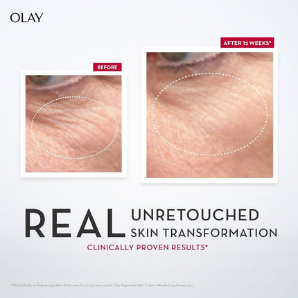 Olay Regenerist Advanced Anti-Ageing Micro Sculpting Serum + Intense Hydration With Hydra Firming Complex, Skin Cream, 50ml by Olay