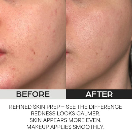 House of Hur Clearing Skin Prep Essence Pad