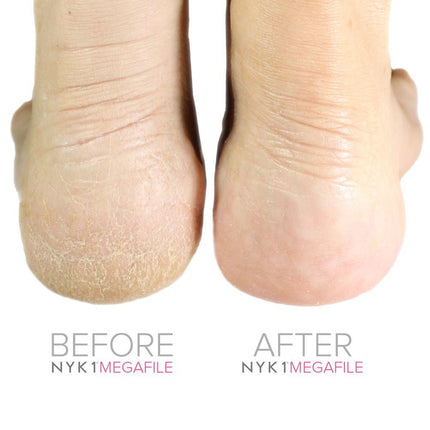 NYK1 Foot File & Smoothie Duo For Healthy Feet | Pink Megafile & Smoothie