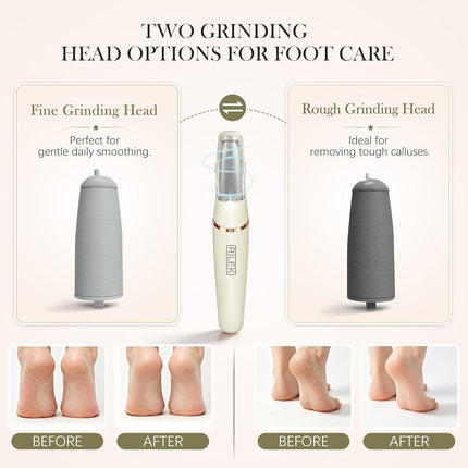 Upgraded Electric Foot File, IRILEKI Callus Removers for Feet, Pedicure Tools for Feet, Rechargeable Portable Foot Callus Remover Pedicure Tools, Foot Care for Dead Skin, for Feet & Hands (Beige)
