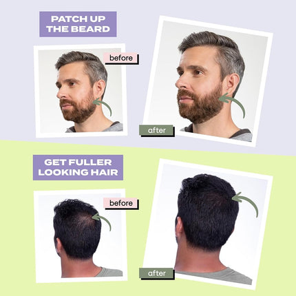 Toppik Hair Building Fibres Dark Brown, 55g - Thicker Fuller Look Instantly, Natural Keratin Protein, Wind Sweat & Rain Resistant, Easy to Apply, For Men & Women who are thinning