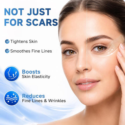 Rvlaim Silicone Scar Sheets, Silicone Scar Tape(5.7” x 1.57” 10 Pcs)