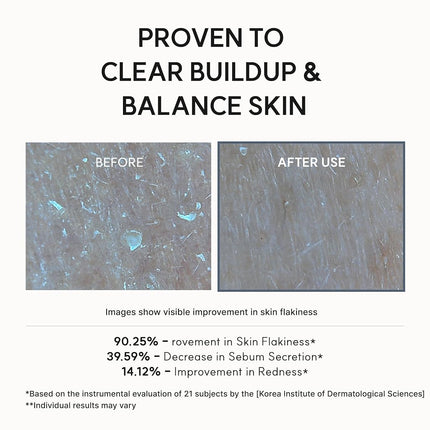 Arencia Eraser Serum Glycolic Acid Booster with AHA BHA, Exfoliating Face Serum for Acne-Prone Skin, Pore Care & Texture Refining, Lightweight Daily Skincare, 30 mL