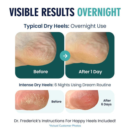 Dr. Frederick's Original Moisturizing Heel Socks for Dry Cracked Heels Treatment - Infused with Olive Oil, Jojoba Oil and Vitamin E - 2 Pairs - Valentines Day Gifts for Her & Him - Original Formula