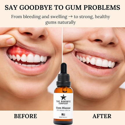 Goodbye Gum Disease - Organic Home Remedy for Oral Gum Disease | 100% Pure Neem and Clove Essential Oils for Oral Care | Effective and Natural Gingivitis Treatment