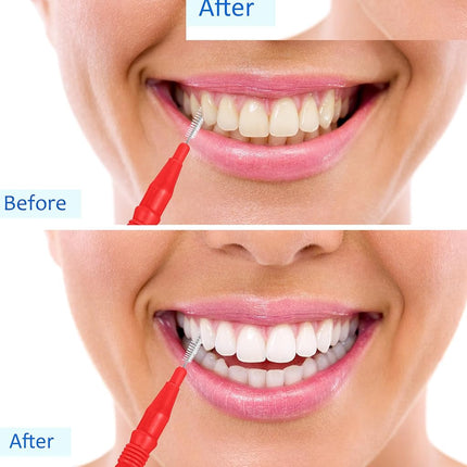 BBTO 100 Pcs Braces Dental Brush Flosser for Cleaner Interdental Brush Toothpick Tooth Flossing Head Oral Dental Toothpick Cleaners Cleaning Tool(Red)
