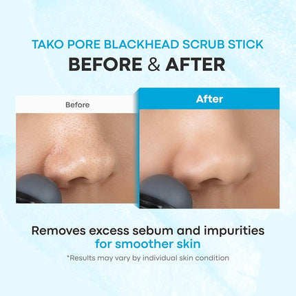 TONYMOLY Tako Pore Blackhead Scrub Stick Duo Set – Deep Pore Charcoal Exfoliator for Nose & T-Zone, Solid Stick with Marine Extracts, Tea Tree Oil & Cellulose Beads (2 Count)