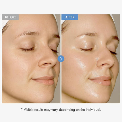 TOSOWOONG Hyaluronic Acid 9 Cream, Daily Face Moisturizer