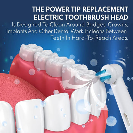 Replacement Toothbrush Heads for Oral B Braun - Ortho and Power Tip Brush Heads Compatible with Oralb Electric Toothbrush - Good for Braces, Crowns, Bridges 20 Pk. Fit The Oral-B Pro 1000, Kids Plus