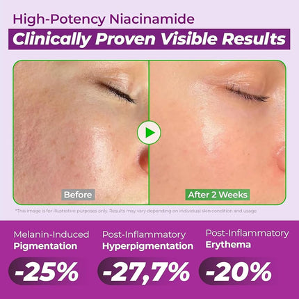 JUMISO Niacinamide 20 Serum - Korean Face Serum with Glutathione, TXA Tranexamic Acid and Centella Complex - Reduces Pigmentation, Uneven Skin Tone, Pore Care for Sensitive Skin, 1.35 fl.oz. 40ml