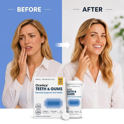 OraTicx Teeth & Gums Dental Probiotic, Naturally Supports Oral Health and Immunity, Oral Probiotics Supplement 8 Billion CFU, Grape Flavor 30 Lozenges 1-PK