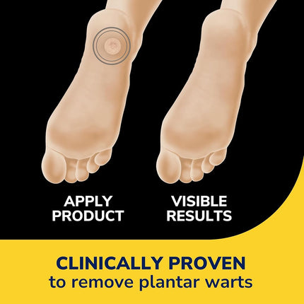 Dr. Scholl’s Clear Away Plantar Wart Remover for Feet, 24 Medicated Discs & 24 Cushioning Pads // Maximum Strength Without A Prescription