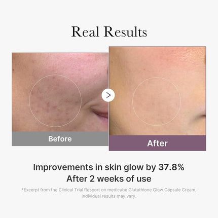 GLUTATHIONE GLOW CAPSULE CREAM