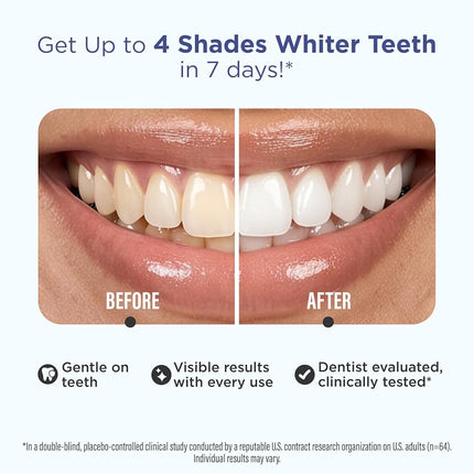 GuruNanda Teeth Whitening Strips - 30-Day Treatment with Non-Slip, Dry Strip Technology - Whitening Designed with Care for a Brighter Smile