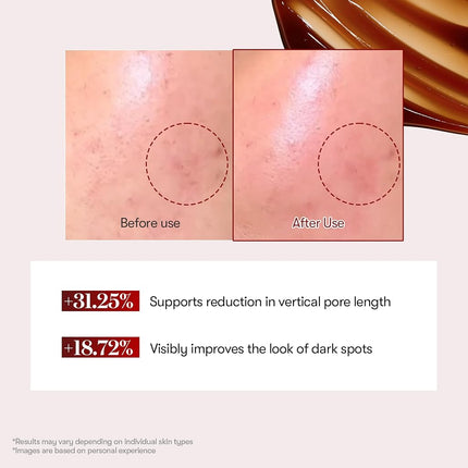 VT COSMETICS Red Booster Reedle Shot 100
