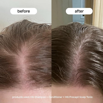 BondiBoost Procapil Hair Tonic 4.23 fl oz - Leave-In Treatment for Thinning Hair - Reduce Hair Fall + Increase Hair Density - Lightweight Non-Greasy Formula - Vegan/Cruelty-Free - Australian Made