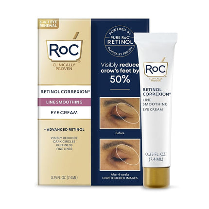 RoC Retinol Correxion Eye Cream, Mini for Dark Circles and Puffiness, Daily Cream, Anti-Aging Cream, Smoothing Care Treatment, 25 oz