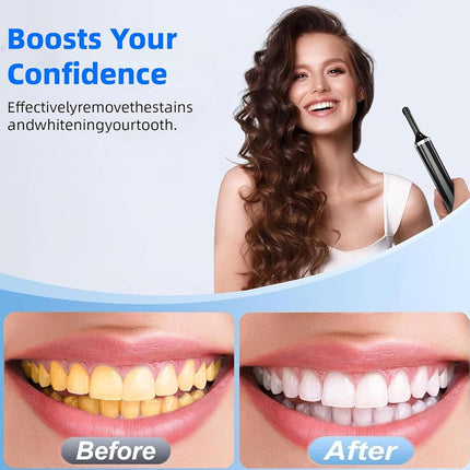 Teeth Polisher with 5 Brush Heads 8 Polish Pastes 5 Speed Modes and LED Light IPX6 Waterproof Tooth Polishing Kit Teeth Cleaner Tools for Home Use Teeth Whitening and Cleaning (Style White)