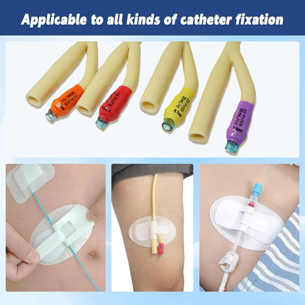Qintan Catheter Stabilization Device (40Pcs), Foley Catheter Supplies, Leg Bag Holder with Extra-Large Self-Adhesive Hook & Loop, Breathable Urinary Tube Stabilizer for PEG/G/J Feeding Tubes