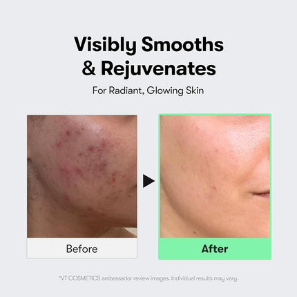 VT COSMETICS CICA Reedle Shot Serum 300