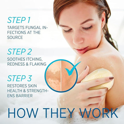 Roycederm Tinea Versicolor Cream & Soap Kit: Soothing Soap