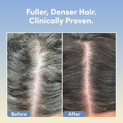 Coco & Eve Boost Therapy Tripeptide Hair Density Serum. For Thicker, Fuller Hair. Anti-Hair Loss & Shedding, Lightweight Scalp Treatment with Biotin & Caffeine for Volume & Restoration (60 ml)