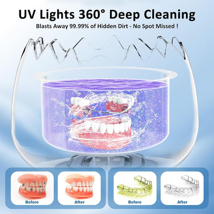 45kHz 180ML Ultrasonic Retainer Cleaner Machine for Denture & Aligner