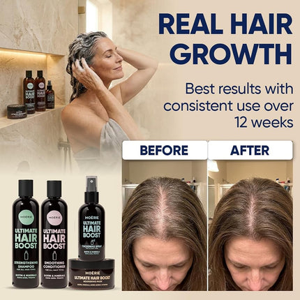 Moerie Shampoo and Conditioner Plus Hair Mask and Spray Mega Pack – The Ultimate Growth Care – For Longer, Thicker, Fuller Hair - Volumizing Products – Paraben & Silicone Free (Set of 4)