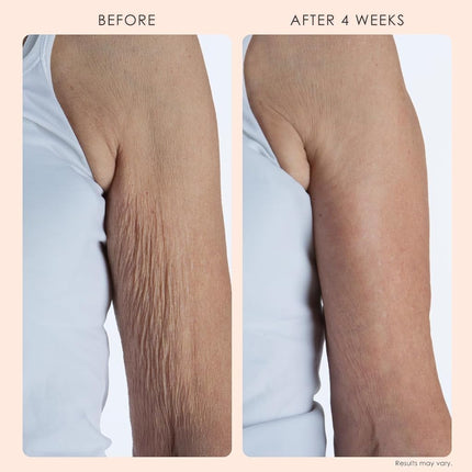 Crepe Erase 2-Step Advanced Body Treatment System Fragrance Free Two Piece Kit