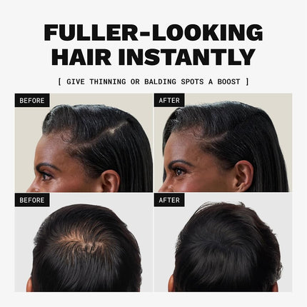 Toppik Hair Building Fibres Dark Brown, 27.5g - Thicker Fuller Look Instantly, Natural Keratin Protein, Wind Sweat & Rain Resistant, Easy to Apply, For Men & Women who are thinning