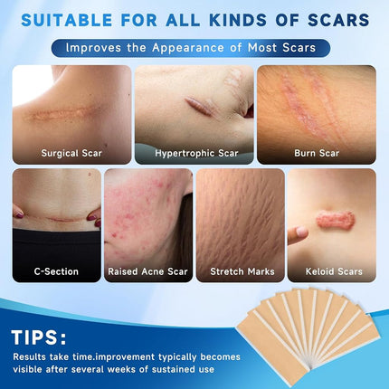 Rvlaim Silicone Scar Sheets, Silicone Scar Tape(5.7” x 1.57” 10 Pcs)
