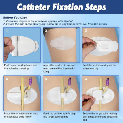 Qintan Catheter Stabilization Device (40Pcs), Foley Catheter Supplies, Leg Bag Holder with Extra-Large Self-Adhesive Hook & Loop, Breathable Urinary Tube Stabilizer for PEG/G/J Feeding Tubes