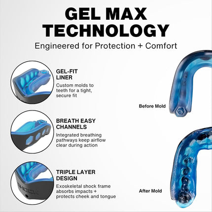 Shock Doctor Gel Max Flavor Fusion Convertible Mouth Guard, Bubble Gum, Adult